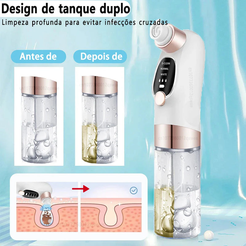 Removedor de Cravos Elétrico com Função de Sucção e Ciclo de Água - Limpeza Profunda de Poros, Acne e Cravos, USB Recarregável