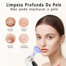 Removedor de Cravos Elétrico com Função de Sucção e Ciclo de Água - Limpeza Profunda de Poros, Acne e Cravos, USB Recarregável
