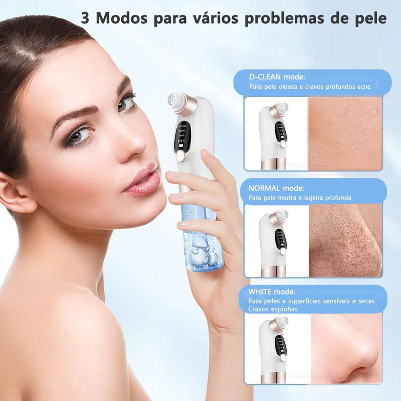 Removedor de Cravos Elétrico com Função de Sucção e Ciclo de Água - Limpeza Profunda de Poros, Acne e Cravos, USB Recarregável
