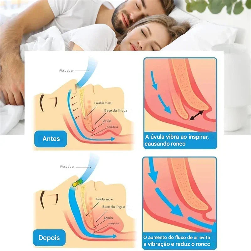 Clipe Nasal Magnético Anti-Ronco – Respire Melhor e Durma em Paz